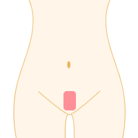 スクエア形