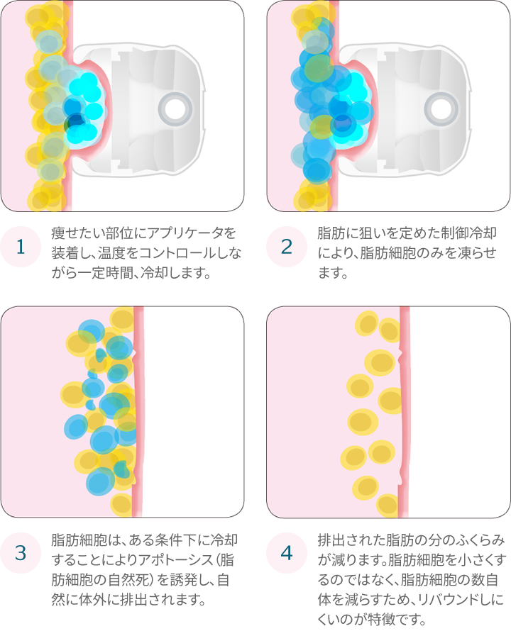 なぜ凍らせると脂肪は減るの?