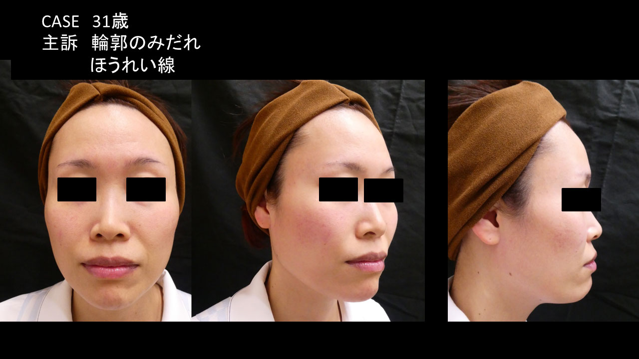 30代女性の症例写真1