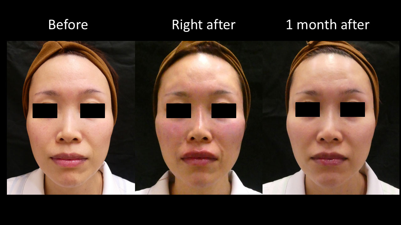 30代女性の症例写真3