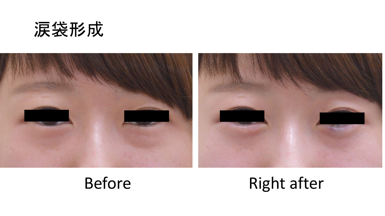 20代女性の症例写真1