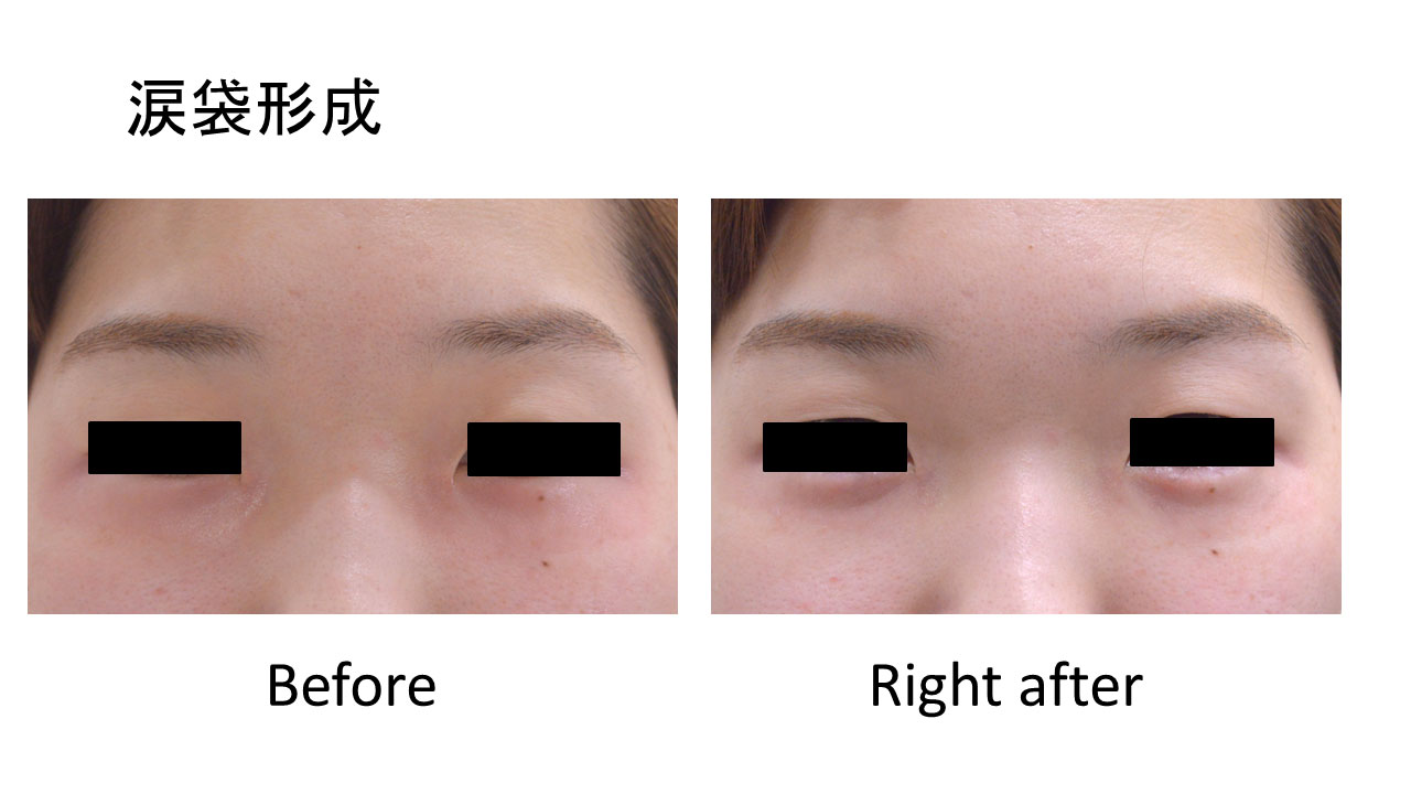 20代女性の症例写真2