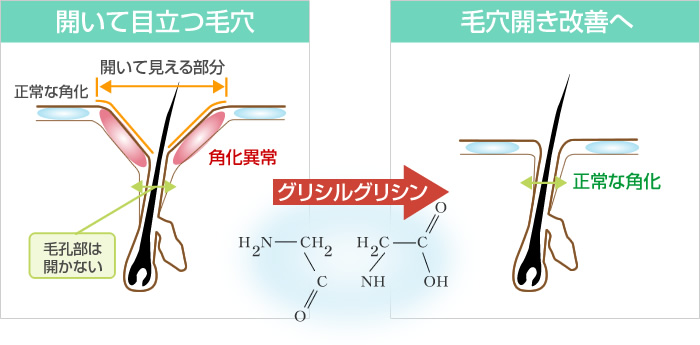 グリシルグリシン