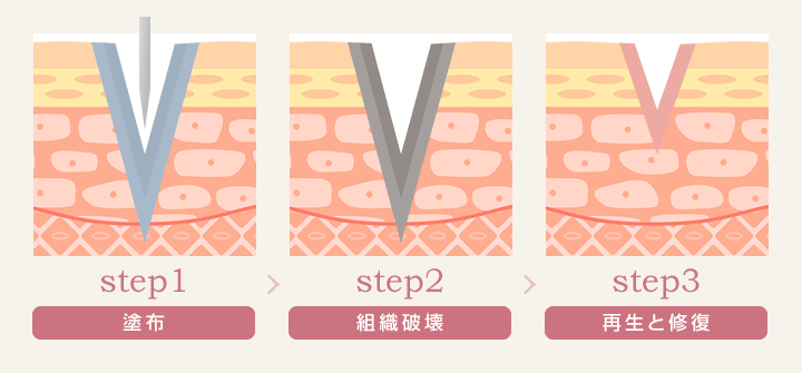 TCAクロス（TCA CROSS）の仕組み