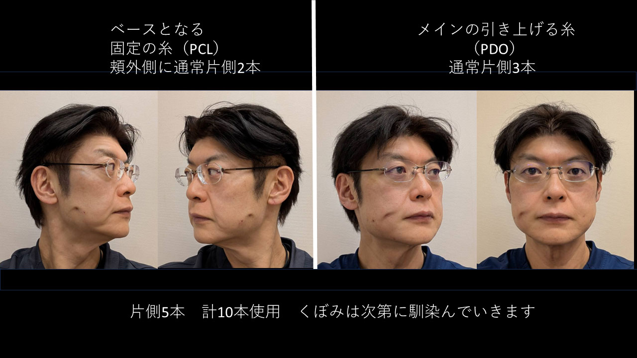 52歳男性医師の症例写真2