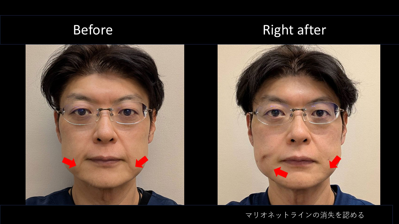 52歳男性医師の症例写真3