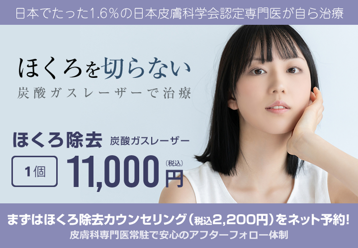 ほくろ1個11,000円、切らないレーザー治療、皮膚科専門医が自ら治療