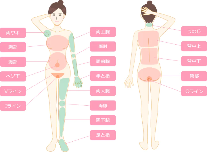 医療脱毛部位紹介のイラスト図