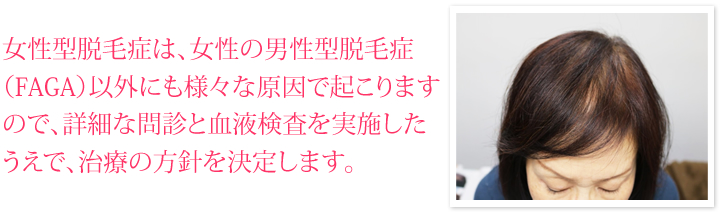 女性型脱毛症は、女性の男性型脱毛症（FAGA）以外にも様々な原因で起こりますので、詳細な問診と血液検査を実施したうえで、治療の方針を決定します。