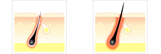 太い毛と細い毛の発熱量の違いのイメージイラスト図