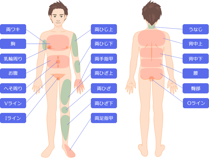 脱毛部位