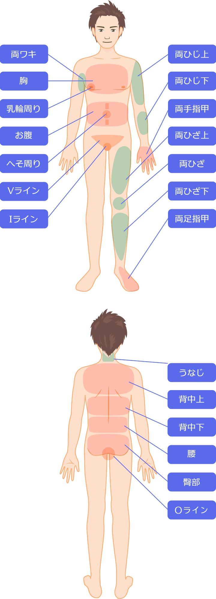 脱毛部位